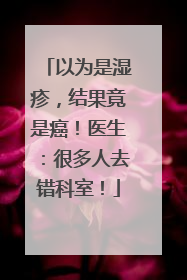 以为是湿疹，结果竟是癌！医生：很多人去错科室！
